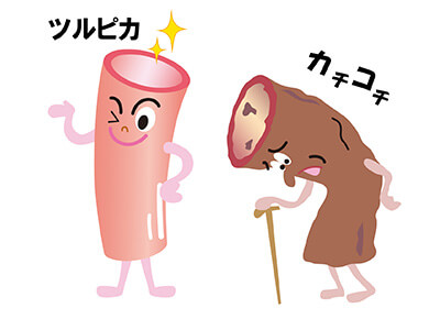 動脈硬化の治療