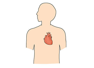 動脈硬化の症状
