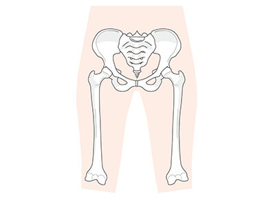骨盤のゆがみによる症状